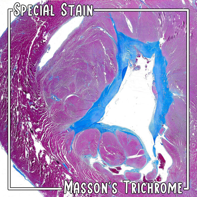 Special Stain Masson S Trichrome Pathology And Ponies