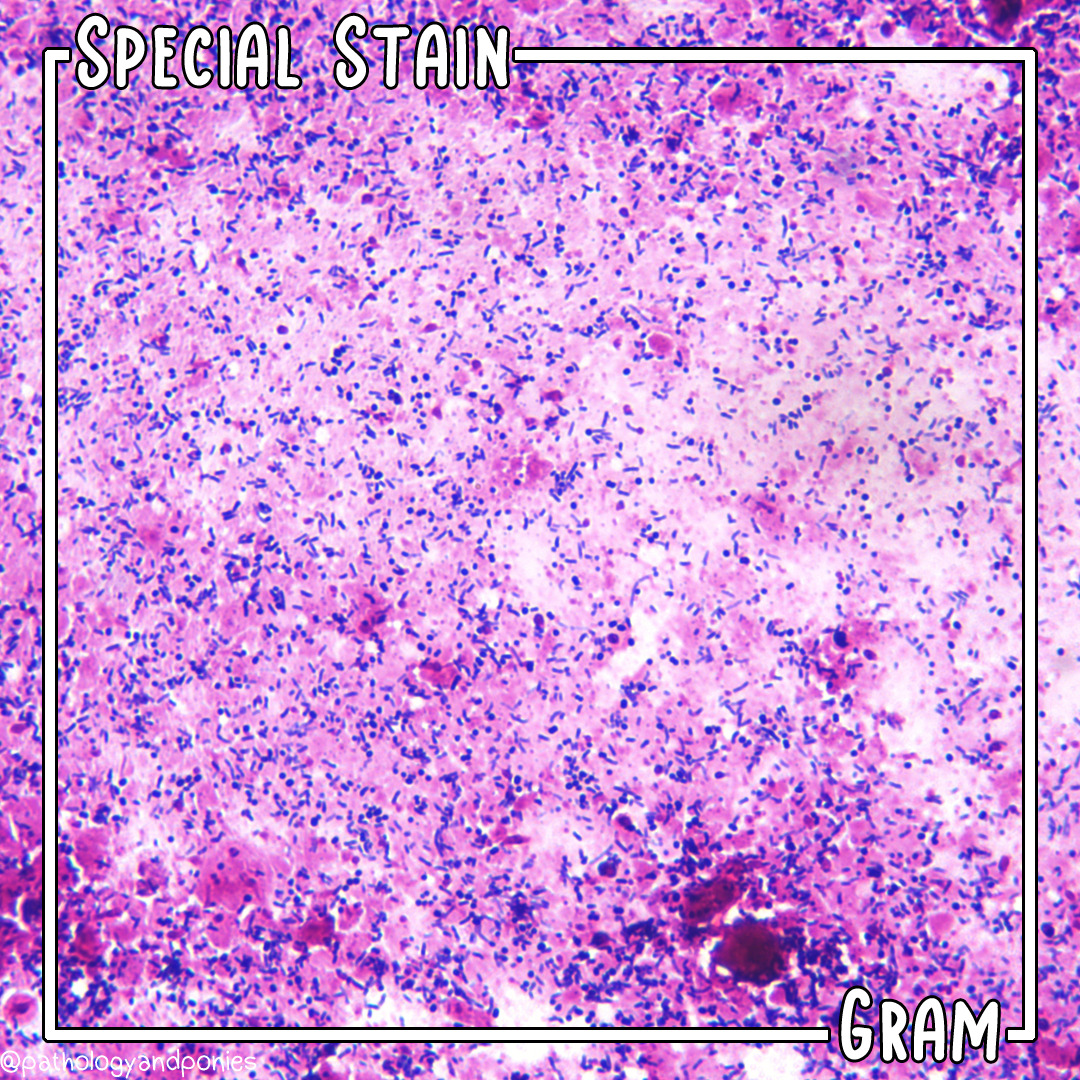 Special Stain: Gram Stain - Pathology and Ponies